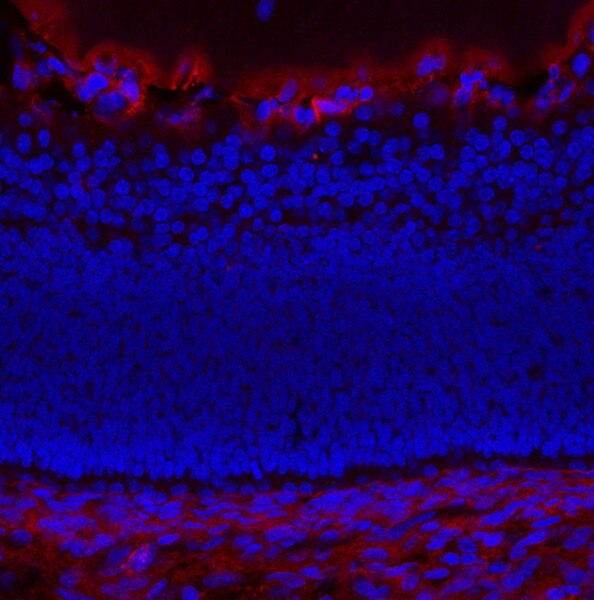 IF of a E 565 mouse retina labeled with DSHB antibody CPTC-SAT1-2 against Spermidine or Spermine N1-Acetyltransferase 1 (red). Image credit: Lachke Laboratory, University of Delaware. 